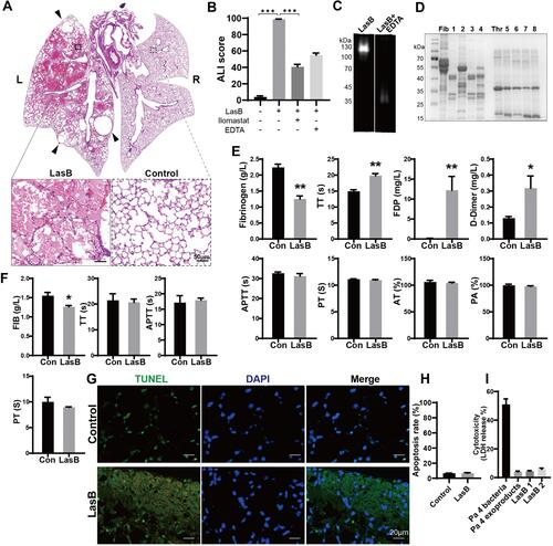 Figure 5 LasB elastase provokes hemorrhagic DAD, degrades extracellular matrix and causes hemostasis disorder (A) HE stain of mice lung unilaterally instilled with 3μg LasB elastase. DAD, hemorrhage, hyaline membranes, neutrophil infiltration and multiple bullae (arrowheads) occurred in LasB treated left lung; L, left; R, right. (B) ALI score of LasB injured lungs and the effect of different LasB inhibitors (n=3 in each group). EDTA: 25 mM; Ilomastat: 1mM. (C) Gelatin zymography of purified LasB and the inhibition effect of EDTA. (D) Degradation of fibrinogen and thrombin with or without inhibitors in vitro. Fib, fibrinogen; 1: LasB + fibrinogen; 2: LasB + ilomastat + fibrinogen; 3: LasB + TLCK + fibrinogen; 4: LasB + TLCK + fibrinogen; Thr, thrombin; 5: LasB + thrombin; 6: LasB + ilomastat + thrombin; 7: LasB + TLCK + thrombin; 8: LasB + TLCK + thrombin; (E) the effect of LasB on overall coagulation function. Blood from healthy donors was incubated with LasB for 35 min, room temperature. (F) The impact of LasB on coagulation function in vivo. Hemostasis of SD rats were measured 1 h after injection of LasB elastase through tail vein. (G) TUNEL stain of LasB injured lung tissue. No apparent cellular apoptosis was found. Cell nuclei (Blue), TUNEL-positive cells (Green). (H) Apoptosis rate of LasB injured lung cells. (I) Cytotoxicity assay of LasB, Pa 4 bacteria or exoproducts to THP-1 cells. LasB 1: 100 μg/mL; LasB 2: 200 μg/mL. *P < 0.05; **P < 0.005; ***P < 0.0005.