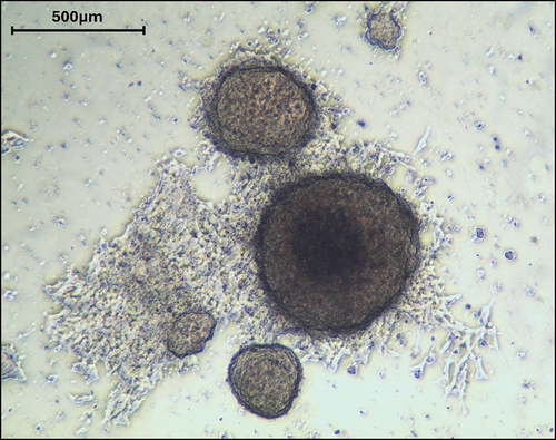 Figure 1. Light microscopic picture of BHG10 SCLC tumorospheres after passaging the cell line in NOD mice and subsequent cultivation in regular tissue culture. The attached cells form spheroids of different sizes, with the largest one beginning to show a darker necrotic core as found previously for 5 other BHGcX lines [Citation48].