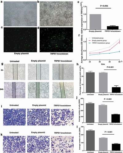 Figure 8. Construction of TRPS1 knockdown gastric cancer cells and cell function in vitro. (a) The distribution of MGC-803 gastric cancer cells transfected with empty plasmid; (b) The green fluorescence emitted by MGC-803 with empty plasmid according to cell distribution; (c) The distribution of MGC-803 gastric cancer cells transfected with TRPS1 knockdown plasmid; (d) The green fluorescence emitted by MGC-803 with TRPS1 knockdown plasmid according to cell distribution; (e) The relative expression of TRPS1 in MGC-803 gastric cancer cells transfected with empty plasmid and TRPS1 knockdown plasmid; (f) The proliferation of gastric cancer cells in three groups; (g) The map of cell scratches in three groups; (h) The percentage change in scratch area in three groups; (i) The membrane penetration of cells in three groups by Transwell migration test; (j) The average number of transmembrane cells in three groups by Transwell migration test; (k) The membrane penetration of cells in three groups assessed by the Transwell invasion test; (l) The average number of transmembrane cells in three groups by the Transwell invasion test. Magnification: 40X (a, b, c, d); Magnification: 200X (g, i, k)