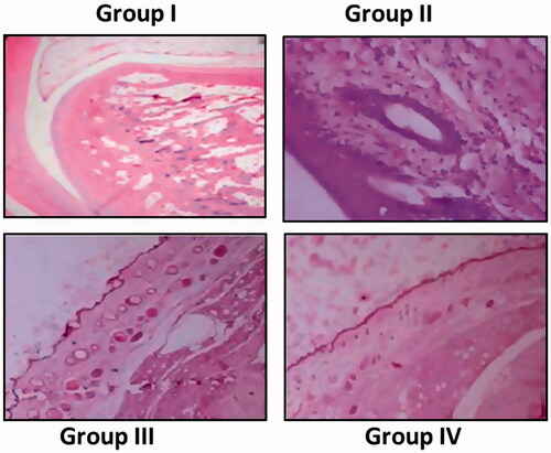 Figure 5. Haematoxylin and eosin staining of sections from the hind paws of rat variations groups. Group I: Control group; Group II: Arthritis induced group; Group III: Arthritis induced + nimbolide group and Group IV: Arthritis induced + Diclofenac Sodium.