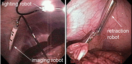 Figure 8. Imaging, lighting, and retraction robots as viewed by endoscope during cooperative NOTES procedure. [Color version available online.]