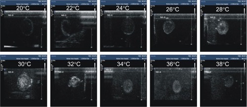 Figure 9 In vitro ultrasonic images of lactoferrin-conjugated poly(aminoethyl ethylene phosphate)/poly(L-lactide) nanobubbles in agarose mold.Note: The temperature was increased from 20°C to 38°C in 2°C intervals.