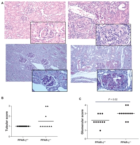 Figure 4 Renal pathology of PPAR-γ+/+ and PPAR-γ−/− two weeks after anti-GBM administration. A Representative photomicrograph of a kidney from a PPAR-γ+/+ (upper left) and PPAR-γ−/− (upper right) with hematoxylin and eosin stain (insert 25 × magnification of glomeruli). Note the severe cellular infiltrate and crescent formation in the PPAR-γ−/− mouse kidney. Representative photomicrograph of a kidney from a PPAR-γ+/+ (lower left) and PPAR-γ−/− (lower right) with periodic acid-Schiff stain. Note the increased deposition of periodic acid-Schiff-positive mesangial matrix in the PPAR-γ−/− mouse kidney. B Tabulation of renal tubular and C glomerular interstitium.Abbreviations: GBM, glomerular basement membrane; PPAR-γ, peroxisome proliferator-activated receptor gamma.
