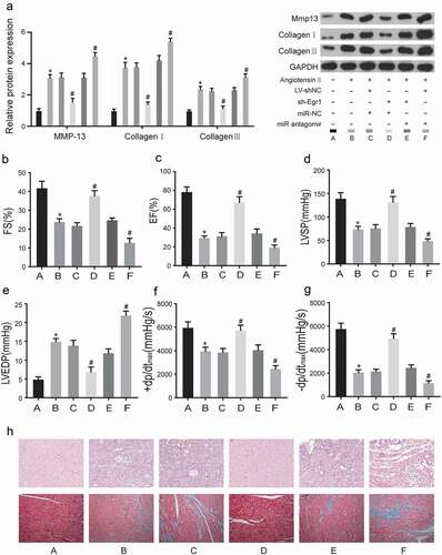 Figure 6. The effects of miR-150-5p and Egr1 on hemodynamics in left ventricle.