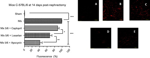 Figure 1. In situ evaluation of superoxide anion (Display full size) in mouse renal cortex tissue at 14 days postnephrectomy. The percentage (%) of red fluorescence emitted by dihydroethidium, a marker of Display full size and therefore an indicator of oxidative stress, is illustrated for the different groups of C-57BL6 mice: Sham (image A), a 5/6 nephrectomy without drug treatment (Nfx, image B), and a 5/6 nephrectomy followed by treatment with captopril (Nfx 5/6 + Captopril, image C), losartan (Nfx + Losartan, image D), or apocynin (Nfx + Apocynin, image E). The greatest reduction in the level of Display full size was found with apocynin. Each bar represents the mean ± standard error and statistical significance (***p < .001, **p < .01, *p < .05) was evaluated by one-way analysis of variance (ANOVA), followed by post hoc and Tukey’s test.