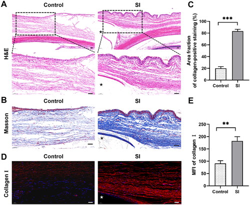 Figure 2. Histopathological assessment in the late remodelling phase following SI. Three eyes with SI surgery were enucleated 8 weeks after surgery (the SI group), and rabbits without any treatment served as controls (n = 3 per group). (A) H&E staining showed a more fusiform fibroblast-like appearance of cells (black arrows) and more compact collagen deposition surrounding the implant compared to the controls. Black asterisk marked the position of the silicone implant. Scale bar: 100 μm (50 μm within the enlarged box). (B) Masson’s trichrome staining demonstrated dense collagen bundles in blue. Black asterisk marked the position of the silicone implant. (C) Quantification of the Masson’s trichrome staining results. Scale bars: 50 μm. ***P < 0.001 compared to the controls; n = 3. (D) Immunofluorescence revealed significant expression of collagen I (red staining). White asterisk marked the position of the silicone implant. (E) Quantification of immunofluorescence staining for collagen I. Scale bars: 50 μm. **P < 0.01 compared to the controls; n = 3.