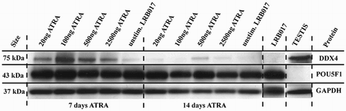 Figure 3.  Western blot analysis of DDX4 and POU5F1 in LRB017 after stimulation with ATRA for 7 and 14 days. ATRA is all-trans retinoic acid dissolved in DMSO. Positive control for DDX4 is human adult testis and for POU5F1 is undifferentiated hESCs (LRB017). All markers analyzed DDX4, POU5F1, and GAPDH showed bands of expected size (75kDa, 43kDa, and 35kDa, respectively).
