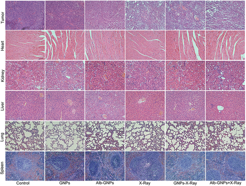 Figure 7 H&E staining of tumor tissues and vital organs in each group (magnification, ×200).