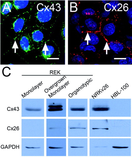 Figure 3. Cx43 is expressed in monolayer REK cultures and Cx26 is up-regulated following REK differentiation. Cx43 was detected by immunofluorescence in all cells grown in monolayer (A, arrows) and these findings were confirmed by Western blot (C). Cx26 was only detected in stratified piles of overgrown monolayer cells (B, arrows). Western blot analysis of monolayers and overgrown monolayers of REKs, as well as organotypic epidermis, revealed the differential regulation of Cx26 and Cx43 with respect to each other and GAPDH (C). NRK cells over-expressing Cx26 (NRKv26) were used as a positive control for both Cx43 and Cx26 while HBL-100 cells were found to be devoid of both Cx43 and Cx26 (C). Bar = 20 μ m.
