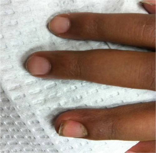 Figure 2 Eight weeks of treatment.