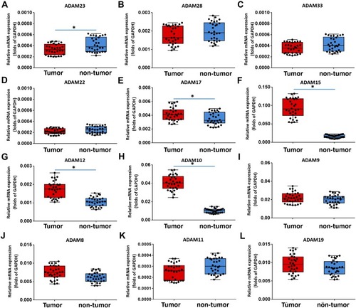 Figure 1 The expression of ADAMs in paired bladder cancer–nontumor specimen. Total mRNA samples from 30 paired bladder tumor and non-tumor specimens were extracted for Ion AmpliSeq Sequencing experiments. The expression of ADAMs (ADAM23 (A), ADAM28 (B), ADAM33 (C), ADAM22 (D), ADAM17 (E), ADAM15 (F), ADAM12 (G), ADAM10 (H), ADAM9 (I), ADAM8 (J), ADAM11 (K) and ADAM19 (L)) in paired bladder tumor and non-tumor specimens is represented as a scatter plot showing the median values of mRNA levels. The differences between bladder tumor and non-tumor specimens were determined (*P < 0.05).