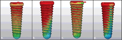 Figure 2. Von Mises values in conical implants: vertical (a) and oblique (b) loading on D1 bone density; vertical (c) and oblique (d) loading on D4 bone density.