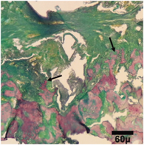 Figure 6. Microscopic section from the healing site of TCP-collagen-treated group on day 30 of healing. Woven bones (arrows) are being to produce (trichrom ×100).