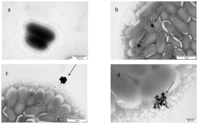 Figure 3 TEM image of Listeria monocytogenes and gold (Au) nanoparticles: a) control; b, c, and d) Listeria monocytogenes with Au nanoparticles. Arrows point to nano-Au (b and d); and to aglomerate of nano-Au (c).