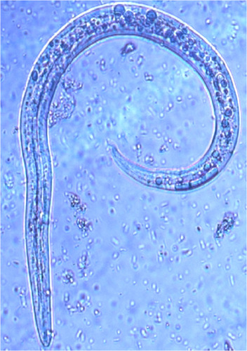 Figure 2 Baermann test: Angiostrongylus vasorum, first stage larva.