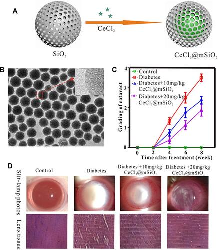 Figure 4 Cerium (III) chloride (CeCl3)-loaded mesoporous silica (CeCl3@mSiO2) nanoparticles. A type of cerium (III) chloride (CeCl3)-loaded mesoporous silica (CeCl3@mSiO2) nanoparticles designed and to prevent the formation of diabetic cataract in vitro and in vivo using a well-established rat model of streptozotocin-induced diabetes. (A) Schematic diagram of CeCl3@mSiO2 nanoparticle preparation; (B) The morphology of the mSiO2 nanoparticles under transmission electron microscopy (spherical, uniform and monodisperse morphology with an average diameter of 85 nm); (C) A line graph, showing the time course of changes in the cataract degrees in different groups of animals; (D) various degrees of cataract and representative images of H&E-stained sections of the lens tissue in experimentally induced diabetic animals 8 weeks after treatment with vehicle or 10 and 20 mg/kg CeCl3@mSiO2 nanoparticles, respectively. Reprinted from Nanomed, 13, Yang J, Gong X, Fang L, et al. Potential of CeCl3@mSiO2 nanoparticles in alleviating diabetic cataract development and progression, 147–1155, Copyright 2017, with permission from Elsevier.Citation110