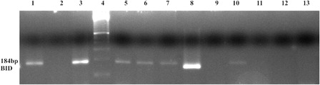 Figure 4. In K562 cell, EZH2 and DNMT1 enzymes were found as bounded to the BID gene promoter region, but in imatinib-resistant K562/IMA-3 cells these enzymes were not seen as bounded to the BID gene promoter. (1) K562 cells BID (+) control, (2) K562 cells BID (−) control, (3) K562 BID 2% input DNA, (4) M: 50 bp, (5) K562 cells EZH2 BID, (6) K562 cells Dnmt1 BID, (7) K562 cells H3K27me3 BID, (8) K562/IMA-3 cells BID (+) control, (9) K562/IMA-3 cells BID (−) control, (10) K562/IMA-3 cells BID 2% input DNA, (11) K562/IMA-3 cells EZH2 BID, (12) K562/IMA-3 cells Dnmt1 BID, (13) no DNA.