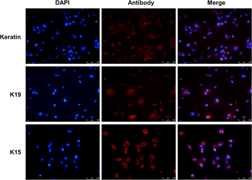 Figure 1 Validation of primary keratinocytes. Immunofluorescence assay detected K15, K19, and Keratin protein expression in primary cells. Scale bar, 100 μm.