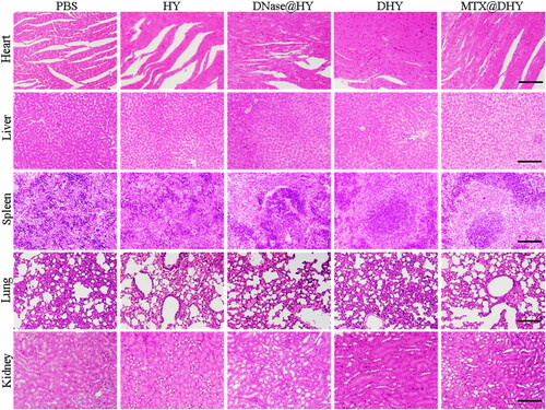 Figure 7. H&E staining of major organs tissues from different groups, scale bar, 200 μm.