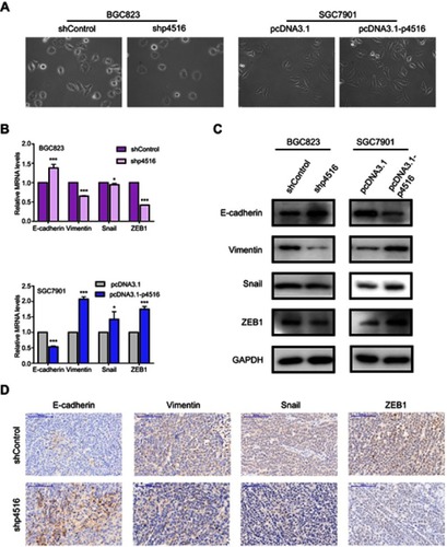 Figure 5 LncRNA p4516 involved EMT in GC cells. (A) Cell morphology changes in p4516 depleted BGC823 cells and overexpressed SGC7901 cells, respectively (magnification, 20×). (B) Relative mRNA expression by qRT-PCR. (C) Western blotting. (D) IHC staining of EMT related markers on mouse xenograft sections. Scale bars=100 μm.Abbreviations: EMT, Epithelial Mesenchymal Transition; GC, Gastric Cancer.