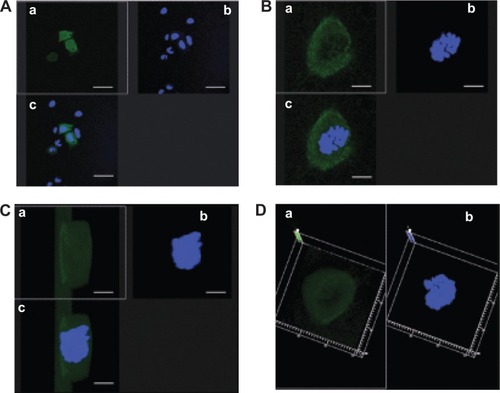 Figure 7 Evaluation of interaction between nanoplexes and HeLa cells by confocal laser scanning microscopy. Cells had been treated with formulation SpDNA for 6 hours, washed and then incubated with fresh medium for 24 hours. (A) Two-dimensional view (bar, 20 μm). (B) Zoom 4× (bar, 5 μm). (C) Three-dimensional view after Z-stack analysis (bar, 5 μm). (D) Three-dimensional view, upper side. (a) GFP filter, (b) Hoechst filter, and (c) overlay. No autofluorescence phenomenon was observed.Abbreviations: GFP, green fluorescent protein; pDNA, plasmid DNA.