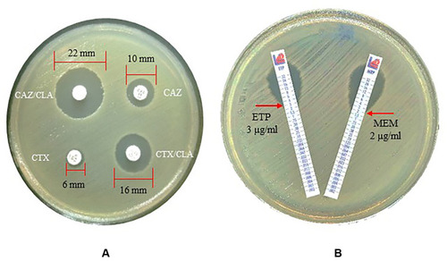 Figure 2 Antimicrobial susceptibility test. (A) Extended-spectrum β-lactamase (ESBL) production was determined by the combination disc test. (B) Carbapenem resistance test by MIC test strips.