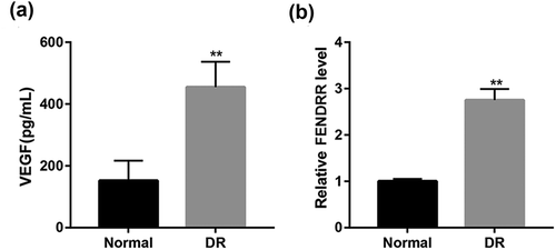 Figure 1. Increased VEGF and FENDRR expression in DR patients. (a) The serum VEGF level in normal subjects and DR patients was detected by ELISA. (b) The relative FENDRR level in blood from normal and DR patients was examined using RT-qPCR. **p < 0.01 vs. the normal group. Student’s t-test was used to analyze the differences between the two groups.