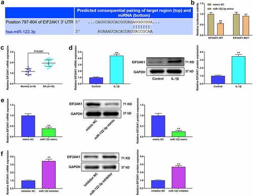 Figure 4. EIF2AK1 is a target gene of miR-122-3p. (a) TargetScan was used for miR-122-3p target gene analysis. (b) Luciferase reporter activity in MH7A cells. **P < 0.01 vs. mimic NC group. (C/D) The EIF2AK1 expression in RA tissues and cells. (E/F) The EIF2AK1 expression in MH7A cells. **P < 0.01.