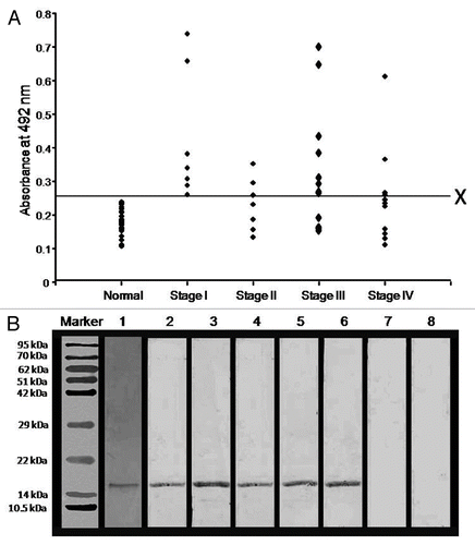 Figure 4. Humoral responses against AKAP4 in ovarian carcinoma patients. (A) Figure Humoral responses against AKAP4 in ovarian cancer specimens obtained from Stage I, Stage II, Stage III and Stage IV patients. X represents the cut-off value (calculated as the mean of antibody titers detected in healthy donors + 2SD) above which all specimens were considered as positive. (B) Immunoblotting experiments were performed to confirm anti-AKAP4 humoral responses and the specificity of circulating anti-AKAP4 antibodies was validated by neutralization experiments. Lane 1, coomassie brilliant blue stained purified recombinant AKAP4 protein; Lane 2, polyclonal anti-AKAP4 antibody showing AKAP4 immunoreactivity; Lane 3–6, AKAP4-immunoreactive bands indicative of AKAP-specific humoral responses in representative stage I, stage II, stage III and stage IV patients; Lane 7, absence of anti-AKAP4 humoral responses in the serum of a healthy donor; Lane 8, absence of AKAP4-immunoreactive bands upon the pre-incubation of the patient's serum with 15 μg/mL recombinant AKAP4.