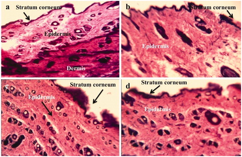 Figure 12. Photomicrographs of rat skin sample: (a) control group showing normal epidermis, dermis and subcutaneous tissues at high power view (magnification 400 × ); (b) NE-treated group; (c) skin sample from AmB-NE gel-treated group; and (d) Placebo gel-treated group.
