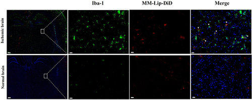 Figure 7 Fluorescence co-localization images of MM-Lip-DiD and microglia, Iba-1: green, MM-Lip-DiD: red, DAPI: blue (scale: 500/50 μm).