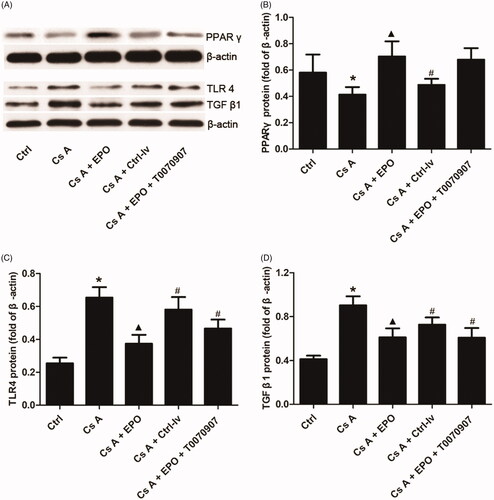 Figure 5. Effects of erythropoietin on protein expression levels of PPAR γ, TLR4, and TGF-β1 in concanavalin A-induced renal injury. (A) The bands of PPAR γ, TLR4, and TGF-β1 in each group. (B) The relative band intensity of PPARγ in each group. (C) The relative band intensity of TLR4 in each group. (D) The relative band intensity of TGF-β1 in each group. Data are presented as the means ± standard error of the mean for six independent experiments. *p < 0.05 versus the control group; ▲p < 0.05 versus the Cs A group; #p < 0.05 versus the Cs A + EPO group.