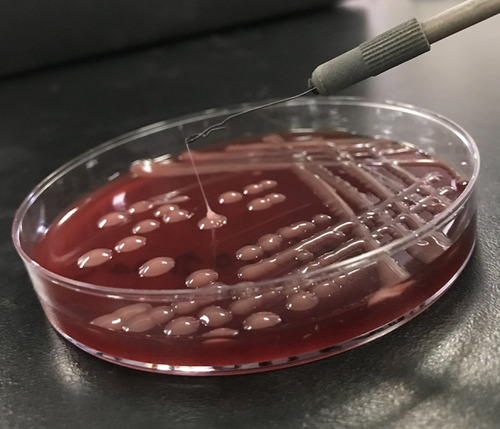 Figure 3 All cultures yielded K. pneumoniae with a positive string test (>5mm in string length).