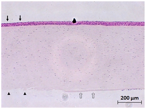 Figure 1 Hematoxylin & eosin staining of the human cornea after three cycles of freezing–thawing. Descemet’s membrane was denuded, and corneal endothelial cells were lost (arrowheads) where the cryoprobe was applied transcorneally (arrows). Adjacent to the probe application site, there was a denuded area with no corneal endothelial cells, although Descemet’s membrane was present (empty arrows). Original magnification X100.