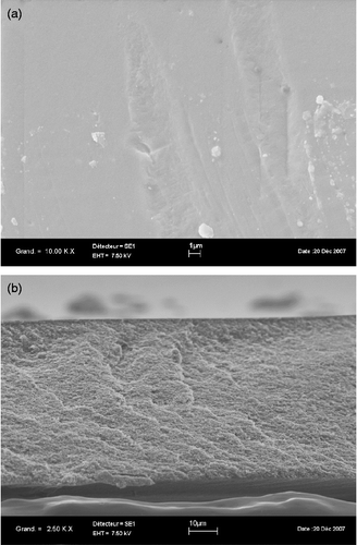 Figure 5 SEM image of the skin (a) and of the cross section (b) of the membrane obtained with 20% w/w CA, 6% CaCl2 and methyl lactate as a solvent.