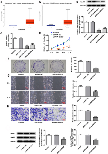 Figure 1. RAB26 silence inhibits A549 cells proliferation, migration and invasion.