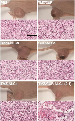 Figure 6. H&E staining of tumor sections separated from the treated mice. Scale bar: 200 μm.