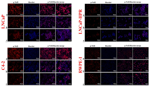 Figure 4. Immunofluorescence analysis shows the effect of the increasing Cab concentrations on the p-Nrf2 expression and subcellular localization in the Cab-treated cell lines. On the horizontal axis of the microphotograph group for each cell line, (a) control, (b) 5 nM, and (c) 10 nM Cab. For each group, six independent images were obtained. In the groups for each cell line, the last two columns are the merged images for the indicated protein and nuclear staining with Hoechst dye. The scale bar represents 100 µm at 20X magnification. However, the microphotographs in the last column were obtained as larger images using a 50 µm scale bar at 20X magnification.