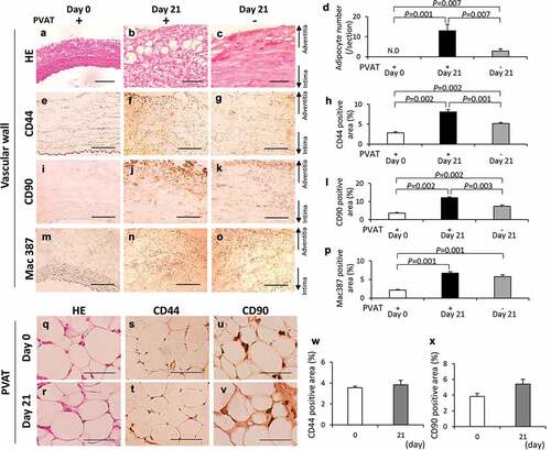 Figure 4. Effects of the perivascular adipose tissue (PVAT) removal on the number of adipocytes and the areas positive for CD44, CD90 and Mac387 in the vascular wall. Representative images of hematoxylin-eosin (HE) staining (a–c) and the number of adipocytes (d). Representative images of the immunostaining for CD44 (e–g) and quantification of CD44 positive areas (h). Representative images of the immunostaining for CD90 (i–k) and quantification of the CD90 positive areas (l). Representative images of the immunostaining for Mac387 monocytes/macrophages (m–o) and quantification of Mac387 positive areas (p). (scale bar = 100 µm) Vascular wall without the induction of hypoperfusion (day 0) (n = 6), vascular wall with the induction of hypoperfusion (day 21) (n = 8) and PVAT-removed vascular wall with the induction of hypoperfusion (day 21) (n = 6). (q, r) Representative images of HE staining of PVAT on days 0 and 21 after the induction of hypoperfusion. Representative images of the immunostaining for CD44 (s, t) and CD90 (u, v). (scale bar = 50 µm) Quantification of areas positive for CD44 (w) and CD90 (x). Day 0 (n = 4) and day 21 (n = 3).