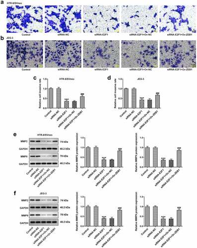 Figure 6. Overexpression of ZEB1 rescues the suppressing effects of E2F1 knockdown on trophoblast invasion. HTR-8/SVneo and JEG-3 cells were transfected with siRNA-E2F1 or co-transfected with siRNA-E2F1 and Ov-ZEB1. (a–d) Transwell assays for determination of trophoblast invasion. (e, f) Western blot assay for determination of MMP2 and MMP9 expressions. ***p < 0.001 versus siRNA-NC, ###p < 0.001 versus siRNA-E2F1+ Ov-NC.