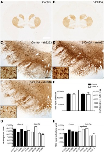 Figure 2 TH-ir nigral cell counts and volumes are variable in 6-OHDA-treated monkeys. Microphotographs of TH immunostained striatum at the level of the anterior commissure of control (A) and 6-OHDA-treated (B) monkeys, and in the left substantia nigra of a control (C, c), a 6-OHDA-treated monkey without reaction to toxin (D, d), and a 6-OHDA-treated monkey with a mild reaction to toxin (E, e). Stereological analysis of averaged TH-ir nigral cell counts and volumes show no difference between groups (F). TH-ir nigral cell counts for individual animals show no significant difference in the control group, but significant differences were found in 6-OHDA-treated animals, with r01098, rh2316, and rh2318 showing a smaller number of nigral cells than r04094 (G). TH-ir nigral cell volumes for individual animals show no significant difference in the control group, but significant differences were found in 6-OHDA-treated animals, with a lower nigral volume found in r01097 and r01098 compared with r04094 and decreased volumes in rh2316 and rh2318 compared with all other 6-OHDA-treated animals (H). *P<0.05, **P<0.01, ***P<0.001. Scale bar: (A and B) =10 mm, (C–E) =500 μm; insets =10 μm.Abbreviations: 6-OHDA, 6-hydroxydopamine; TH, tyrosine hydroxylase; ir, immunoreactivity.