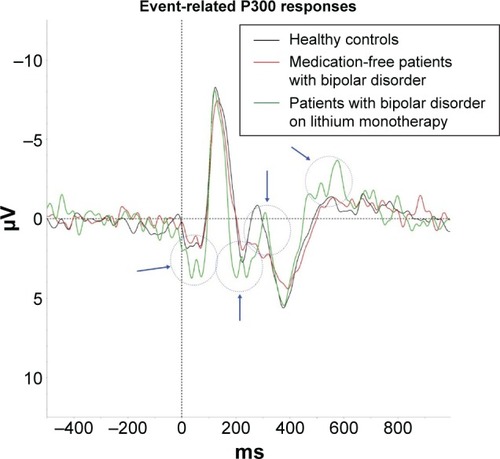 Figure 1 Event-related P300 responses of the patients with bipolar disorder on lithium monotherapy compared with medication-free patients with bipolar disorder and healthy control subjects in auditory oddball experiments.