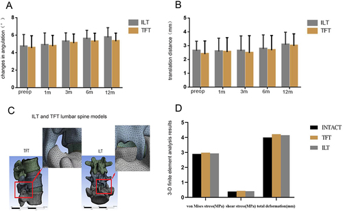 Figure 6 Effects of lumbar stability over time and 3-D finite element analysis. (A) The change in angulation of the spine in different groups. (B) The translation distance of the spine in different groups. (C) Establishment of ILT and TFT lumbar spine models. (D) 3-D finite element analysis results of spine models.