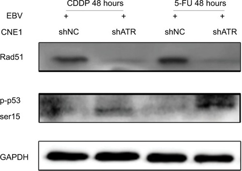 Figure 6 ATRi increases p53 phosphorylation and impairs Rad51 formation.Notes: shATR- and shNC-transfected EBV-positive CNE1 cells were treated with 10 µM CDDP or 25 µM 5-FU for 48 hours, and cell lysates were immunoblotted with the indicated antibodies.Abbreviations: 5-FU, 5-fluorouracil; ATM, ataxia telangiectasia mutation; ATR, ATM and Rad-3 related; ATRi, ATR interference; CDDP, cisplatin; EBV, Epstein– Barr virus.
