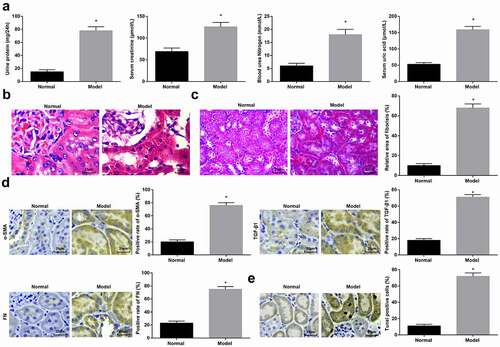 Figure 1. NPSR1-AS1 displayed high expression in TC cells. A-B GTEx and NCBI databases analyzed NPSR1-AS1 expression in various kinds of normal tissues. C RT-qPCR quantified NPSR1-AS1 expression in TC cells (KTC-1, SW1736, KAT-18 and FTC133) and human normal thyroid cells (Nthy-ori 3–1). *P < 0.05, **P < 0.01.