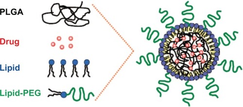 Figure 4 Schematic illustration shows the formulation of lipid polymer hybrid nanoparticles.Citation100Abbreviation: PLGA, poly-d,l-lactide-co-glycolide.