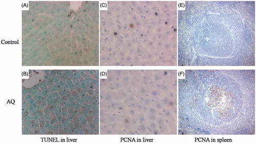 Figure 5. Cell apoptosis and proliferation in the liver and spleen in AQ-treated BN rats. (A) TUNEL staining in the liver of control rats (400×). (B) TUNEL staining in the liver of AQ-treated rats (400×). (C) PCNA staining in the liver of control rats (400×). (D) PCNA staining in the liver of AQ-treated rats (400×). (E) PCNA staining of spleen of control rats (250×). (F) PCNA staining of the spleen of AQ-treated rats (250×).