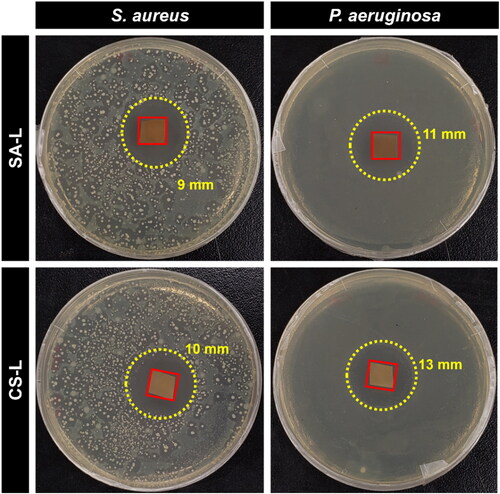 Figure 5. Antibacterial activity of drug-loaded SA-L and CS-L nanofibers against S. aureus and P. aeruginosa.