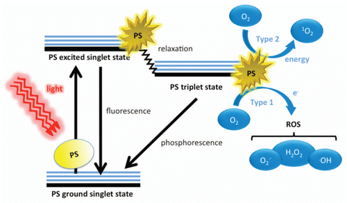 Figure 1 Schematic illustration of photodynamic therapy including the Jablonski diagram. The PS initially absorbs a photon that excites it to the first excited singlet state and this can relax to the more long-lived triplet state. This triplet PS can interact with molecular oxygen in two pathways, type I and type II, leading to the formation of reactive oxygen species (ROS) and singlet oxygen respectively.