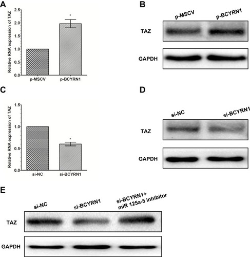 Figure 4 BCYRN1 modulates the expression of the endogenous miR-125a-5p target TAZ. Western blotting was conducted to detect the protein expression of TAZ, while qRT-PCR was performed to detect the mRNA expression of TAZ, after U251 cells were transfected with p-BCYRN1 and p-MSCV. The results showed that BCYRN1 overexpression significantly increased both the mRNA (A) and protein (B) levels of TAZ. (C and D) BCYRN1 knockdown substantially decreased both the mRNA and protein expression of TAZ in U251 cells. (E) The protein levels of TAZ in U251 cells transfected with si-NC, si-BCYRN1, or si-BCYRN1+miR-125a-5p inhibitor were determined by Western blotting. The results indicated that BCYRN1 knockdown suppressed the protein expression level of TAZ, which could be reversed by inhibiting the expression of miR-125a-5p. *p<0.05 vs the negative control group.